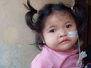 Kisah Pilu Reina Derita Kelainan Langka, Hilang Penglihatan hingga Memori