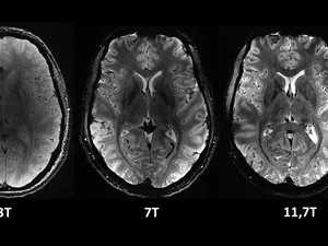 Wujud Otak Manusia Sebenarnya yang Terekam Mesin MRI Paling Canggih