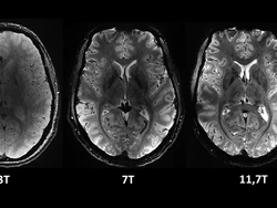 Wujud Otak Manusia Sebenarnya yang Terekam Mesin MRI Paling Canggih