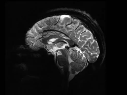 Detail Otak Manusia Akhirnya Bisa Terlihat Berkat MRI Tercanggih di Dunia