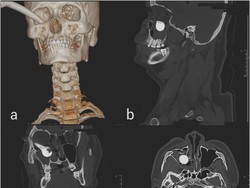 Ngeri! Ada Tuas Rem Motor Nyangkut di Mata Kanan Pria Ini gegara Kecelakaan