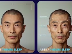 Foto Mencengangkan Wajah yang Tidak Tidur 7 Jam Sehari vs Cukup Tidur