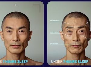 Foto Mencengangkan Wajah yang Tidak Tidur 7 Jam Sehari vs Cukup Tidur Foto Mencengangkan Wajah yang Tidak Tidur 7 Jam Sehari vs Cukup Tidur