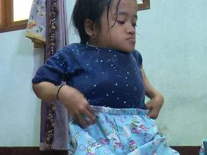 Kisah Rahma, Anak Guru Honorer Penderita Penyakit Tulang Langka