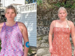 Kisah Wanita Terlahir Tak Bisa Tersenyum, Ternyata Idap Kondisi Ini