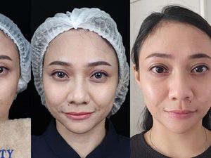 Treatment Juvenation 7D by DL Signature, Perawatan untuk Wajah Awet Muda