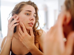 7 Cara Menghindari Jerawat Agar Wajah Selalu Glowing dan Flawless