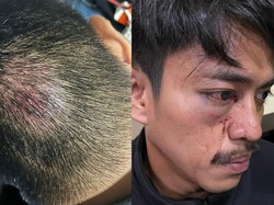 Duduk Perkara 2 Warga Kolaka Babak Belur Diduga Dikeroyok Oknum Polisi