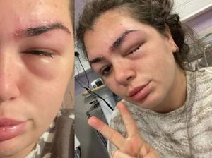 Viral Wanita Sulam Alis Berujung Fatal, Mata Kiri Tak Bisa Melihat hingga Terancam Buta Viral Wanita Sulam Alis Berujung Fatal, Mata Kiri Tak Bisa Melihat hingga Terancam Buta