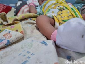 Kondisi Terkini Bayi Korban Dibanting-Ditempeleng Ayah Kandung di Surabaya