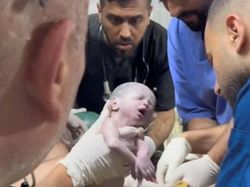 Potret Pilu Kelahiran Bayi yang Ibunya yang Terbunuh oleh Israel