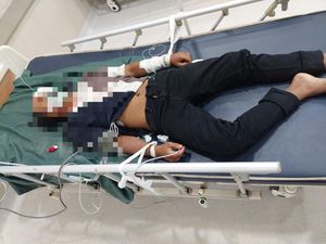 Pria Misterius Penuh Luka Bagian Wajah Tergeletak di Jalanan Mengwi