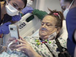 Fakta-fakta Kematian Penerima Cangkok Ginjal Babi, Sempat Alami Penolakan Organ