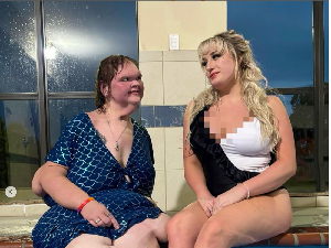 Penampilan Mengejutkan YouTuber Dulu Beratnya 329 Kg, Kini Jadi Begini