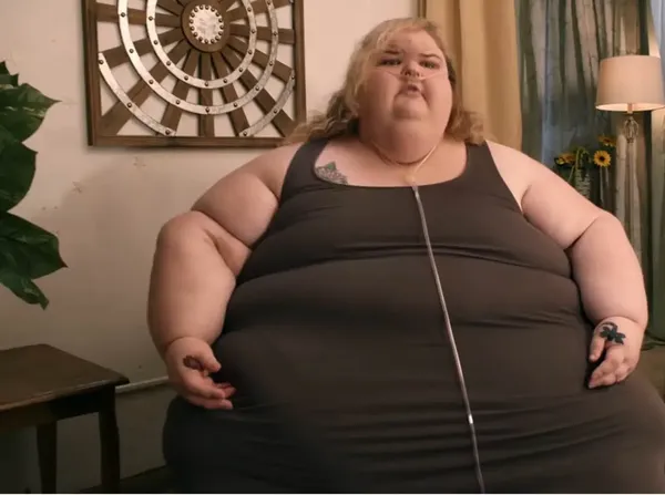 Foto: Before Vs After Wanita Sukses Pangkas BB hingga 225 Kg, Auto Pangling!