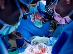 Begini Cara Ilmuwan Modifikasi Ginjal Babi Agar Cocok untuk Tubuh Manusia