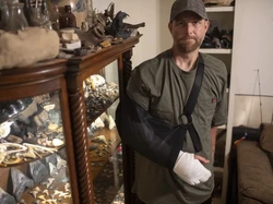 Penyelam Ini Diseret Aligator ke Dasar Sungai, Tangan Putus, Beruntung Selamat