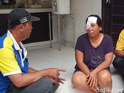 Anjing Diduga Rabies Mengamuk Gigit 8 Warga di Jembrana