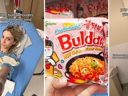 Ngeri! Wanita Ini Masuk Rumah Sakit Usai Makan Samyang Buldak