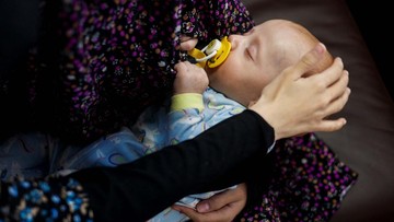 Derita Bayi-bayi di Gaza Tak Kunjung Usai, Kini Terancam kena Meningitis