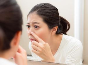 7 Letak Jerawat dan Artinya, Waspada Jika Berjerawat di Dahi hingga Dagu 7 Letak Jerawat dan Artinya, Waspada Jika Berjerawat di Dahi hingga Dagu