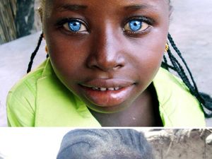 Keunikan Genetik yang Dimiliki Orang-orang di Dunia, Kamu Juga Punya?