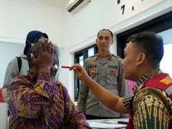 Polres Ponorogo Bantu 6 Orang Operasi Katarak dan 1 Anak Bibir Sumbing