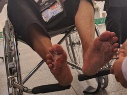 Calon Jemaah Haji Surabaya Diminta Antisipasi Kaki Melepuh di Tanah Suci