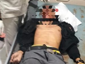 Kecelakaan Maut Motor Vs Pikap di Flores Timur, 1 Orang Tewas Kecelakaan Maut Motor Vs Pikap di Flores Timur, 1 Orang Tewas