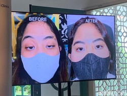 Kisahnya Viral di TikTok, Wanita Mata Ngantuk Buka-bukaan soal Kelainan Ptosis