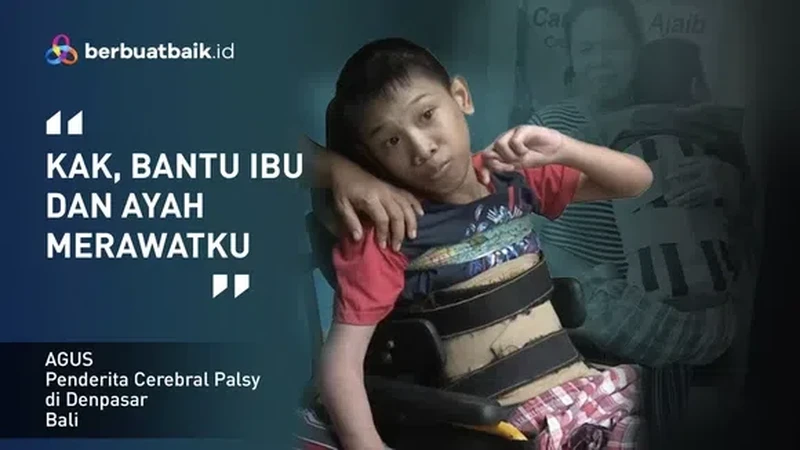 Cerita Anak Juru Parkir Penderita Cerebral Palsy yang Berjuang Sembuh