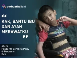 Cerita Anak Juru Parkir Penderita Cerebral Palsy yang Berjuang Sembuh