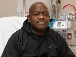 Pria Penerima Cangkok Ginjal Babi Meninggal 2 Bulan Pasca Operasi