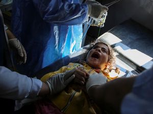 Jerit Anak-anak Palestina yang Terluka Akibat Serangan Israel