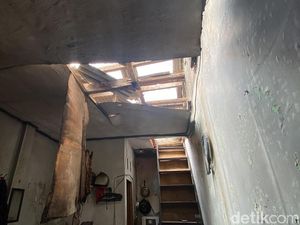 Kondisi Terkini Bocah Korban Gas Meledak di Bandung Kondisi Terkini Bocah Korban Gas Meledak di Bandung