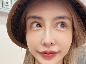 Melalui Pemindai Bandara, Model Kaget Nemu Benda Aneh di Wajah