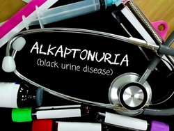 Alkaptonuria