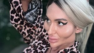 Foto Before After Wanita Pemilik Pipi Terbesar di Dunia, Dulu Tampil Normal