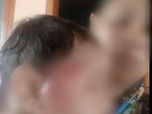 Bayi 8 Bulan di Probolinggo Dianiaya Ayah Kandung Bayi 8 Bulan di Probolinggo Dianiaya Ayah Kandung
