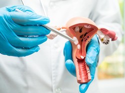 Penjelasan Ahli soal Viral Rahim Copot Usai Lahiran