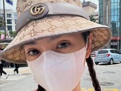 Ini Wajah Baru Angel Karamoy, Dua Bulan Setelah Operasi Plastik