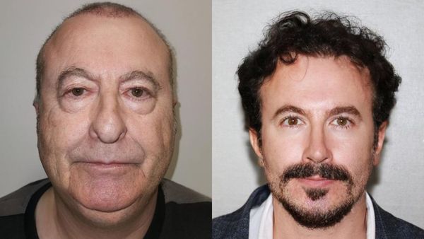 Begini Penampilan Pria usai Oplas yang Bikin Terheran-heran, Disebut Editan