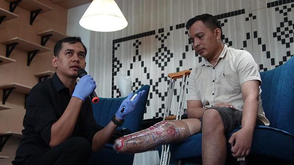 Upaya Membantu Penyandang Disabilitas lewat Cipta Karya Inovatif