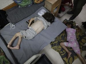 Potret Pilu Anak-anak Palestina Menderita Malnutrisi Akut