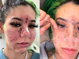 Viral Tiktoker Nekat Pakai Skincare Kedaluwarsa, Wajahnya Jadi Begini