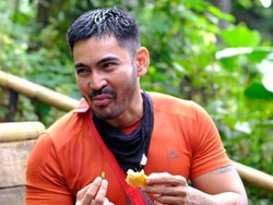 Robby Purba Rasa Ada Benjolan Lagi di Payudara Usai Operasi Tumor 2 Tahun Lalu