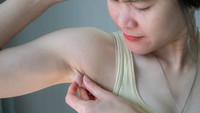 Ada Benjolan di Ketiak Kiri, Kapan Harus Waspada dan Cek Dokter?