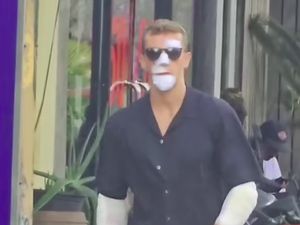 Viral Bali Kiss, Ketika Bule Pamer Perban karena Jatuh dari Motor