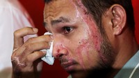 Faisal Halim menangis dalam jumpa pers itu. Pemain Timnas Malaysia itu mengalami musibah yang membuat sebagian wajahnya rusak akibat luka bakar. (Foto: Hasnoor Hussain/REUTERS)