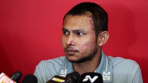Foto: Penampakan Perdana Faisal Halim Usai Disiram Air Keras